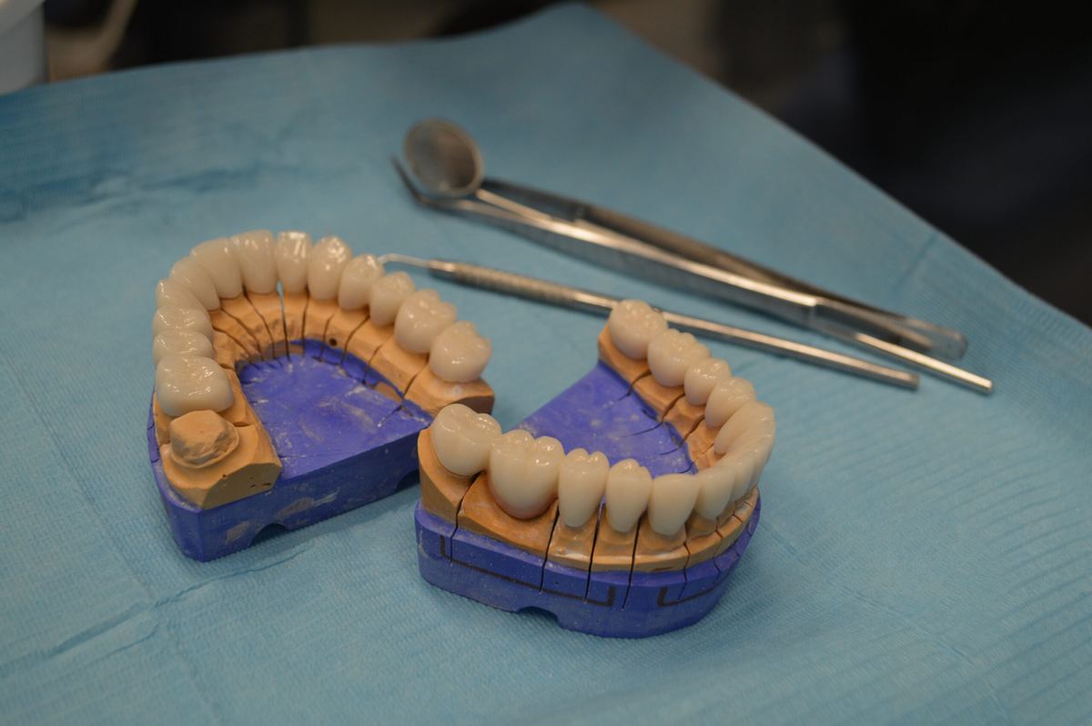 Prosthetic work