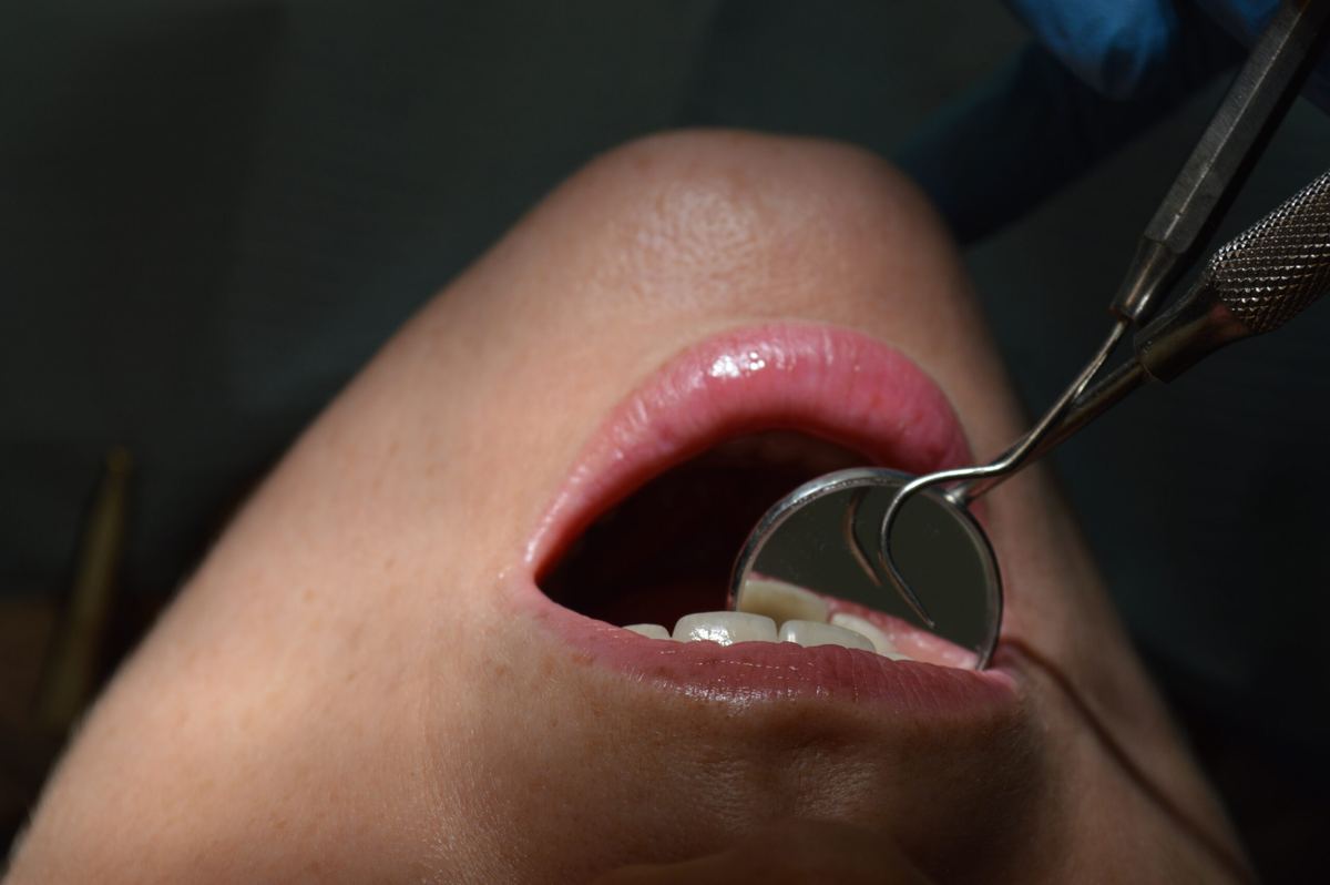 Orthodontic treatment in the clinic