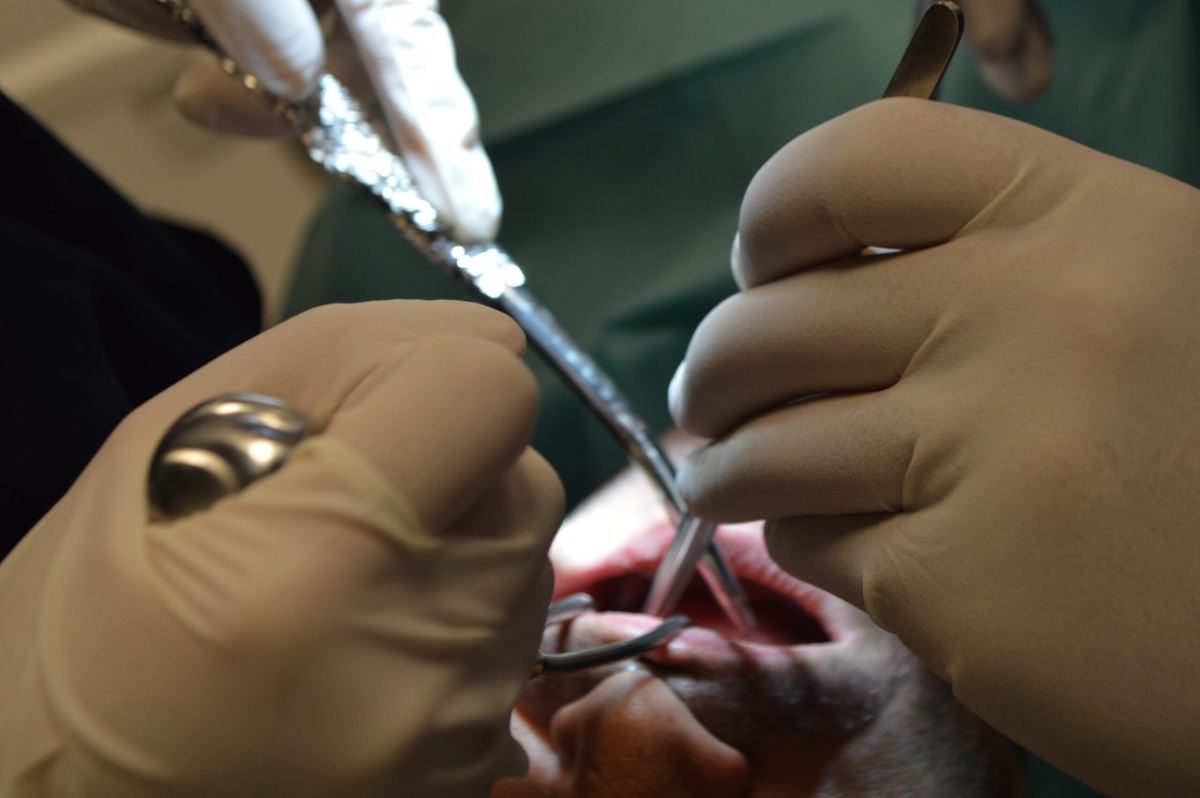 Oral surgery