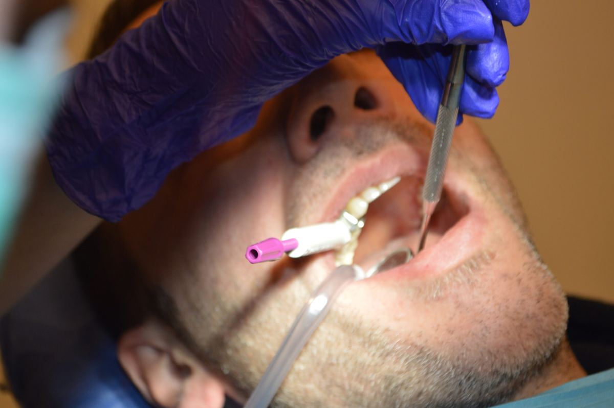 Endodontic treatment
