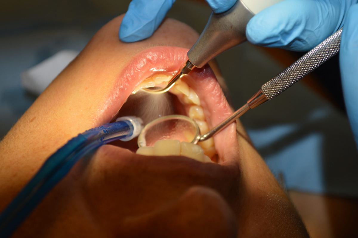 Prophylaxis in the clinic