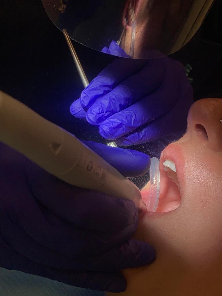 Treated case