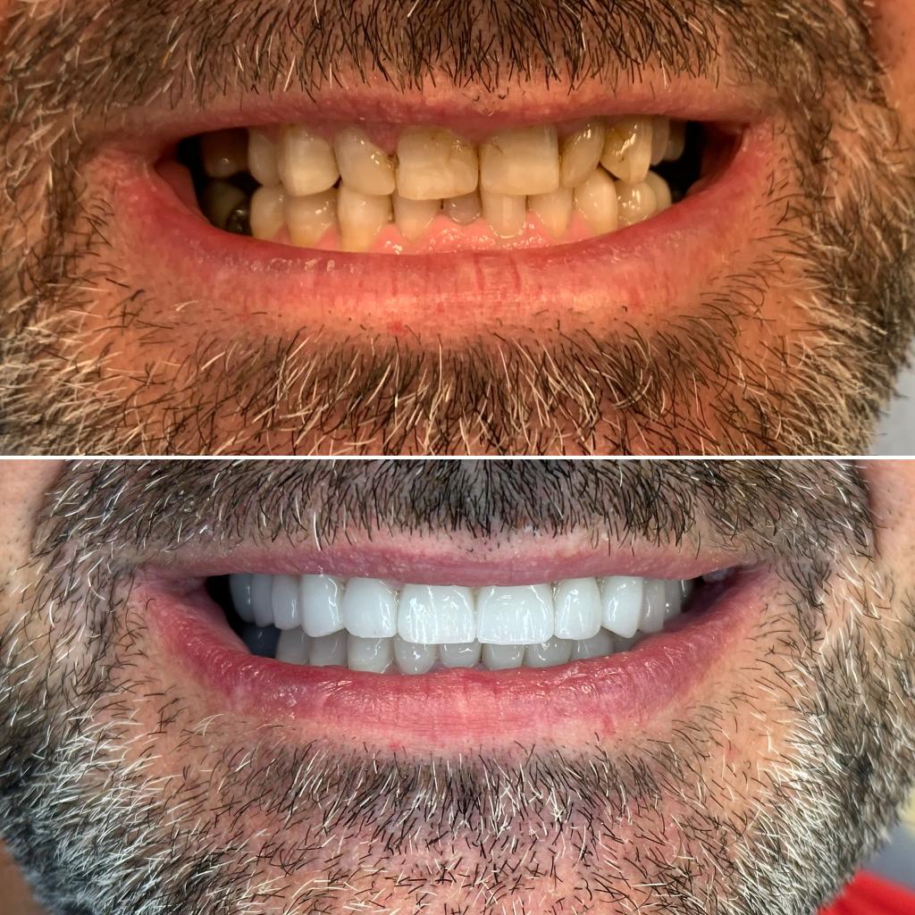 Treated case