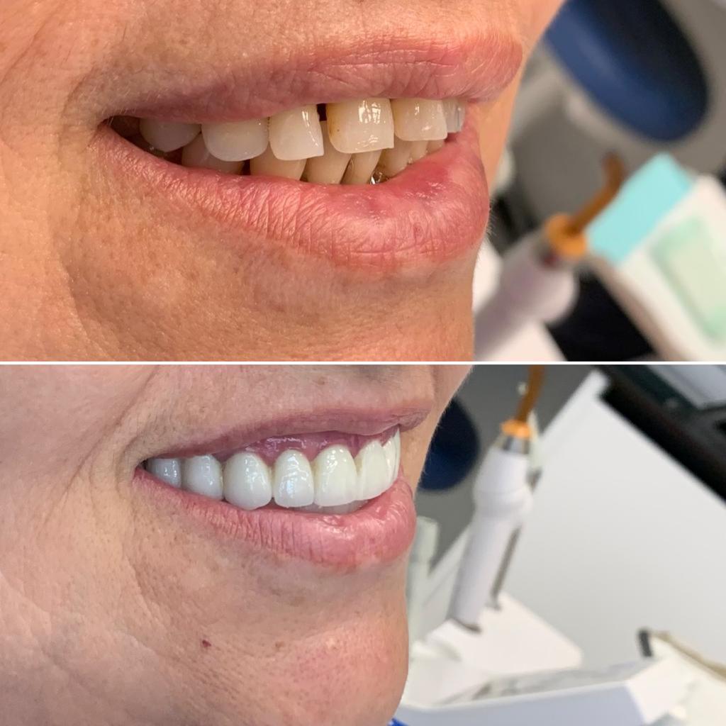Treated case
