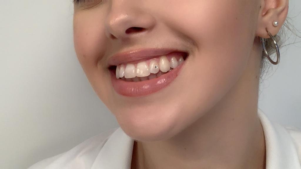 Treated case