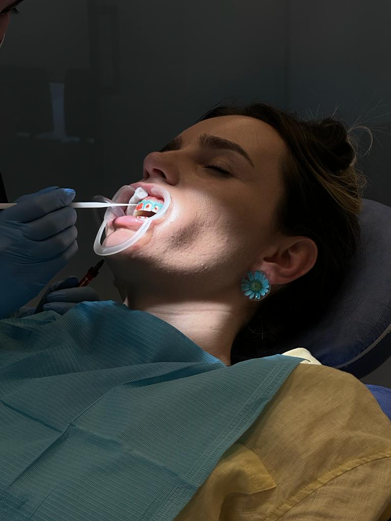 Treated case